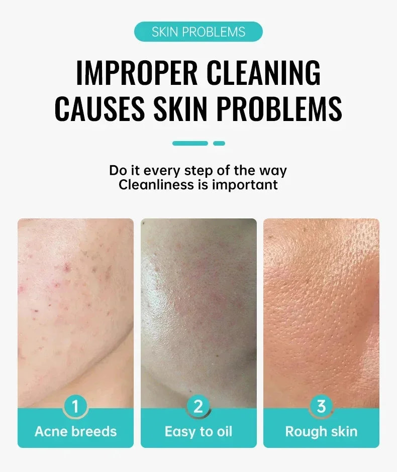 Crème Anti-Acné à l'Acide Salicylique Réparation Anti-Acné Rougeurs Boutons Nettoyage Profond des Pores Contrôle du Sébum Hydratation Soin de la Peau